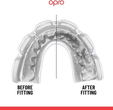 Індивідуальна капа OPRO для брекетів, виготовлена стоматологом, для максимального захисту та комфорту. Захисна капа для регбі, боксу, хокею, ММА, лакросу та єдиноборств, прозоро-біла