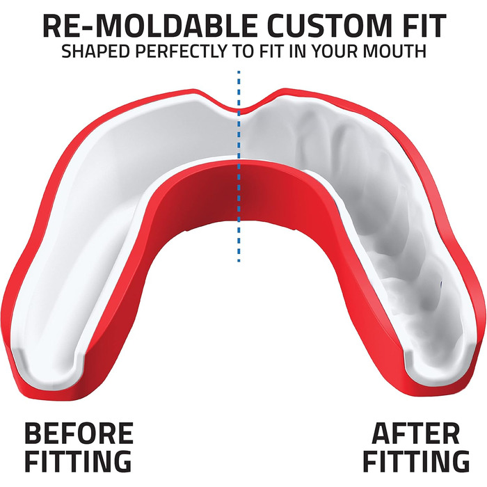 Капа спортивна преміум-якість Titanium - захист щелепи для контактних видів спорту (бокс, ММА, джудо, карате, регбі, хокей, футбол) - червона, з кейсом