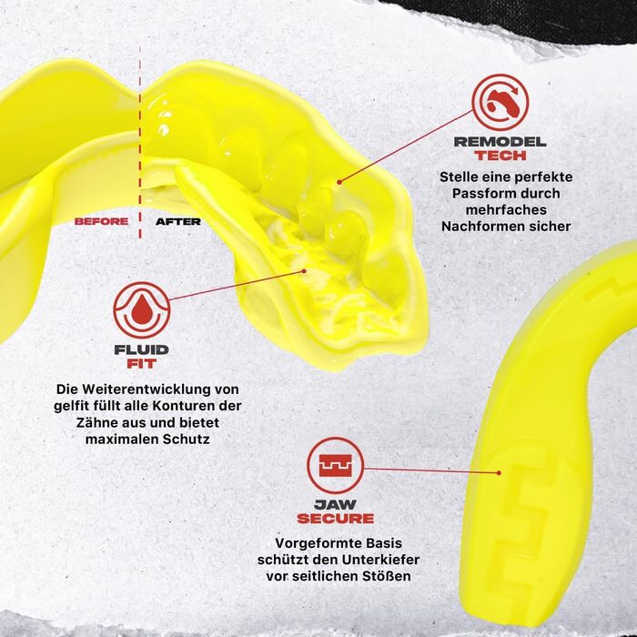SAFEJAWZ Захист зубів для спорту: дорослі та діти. Захист для контактних видів спорту (регбі, бокс, кікбоксинг, хокей)