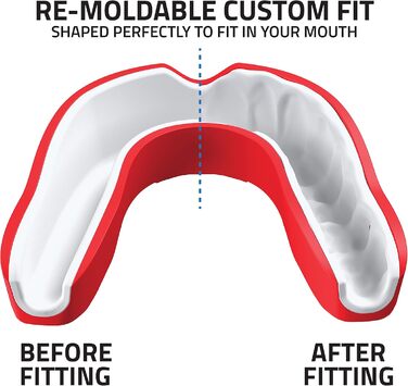 Капа спортивна преміум-якість Titanium - захист щелепи для контактних видів спорту (бокс, ММА, джудо, карате, регбі, хокей, футбол) - червона, з кейсом